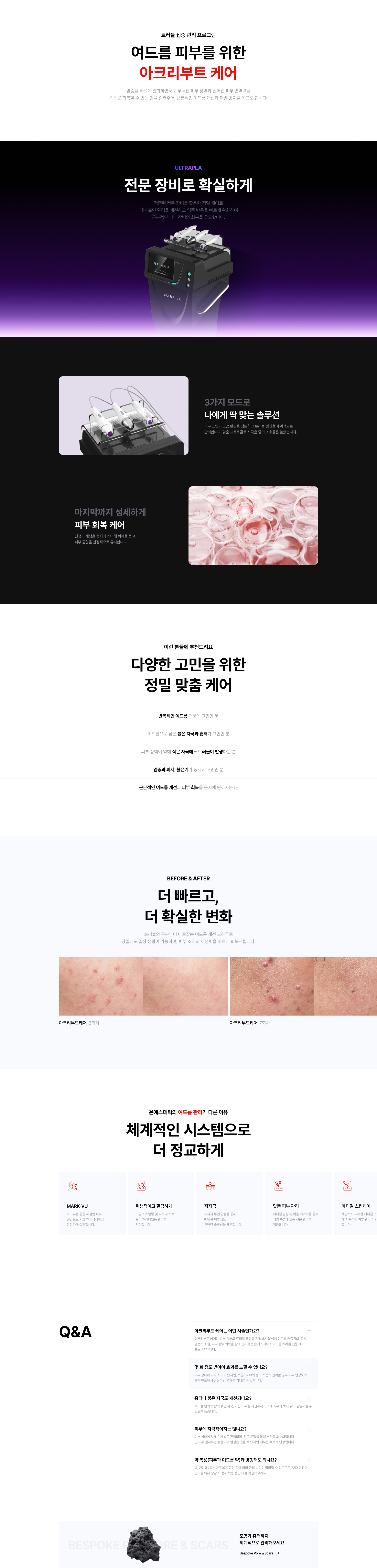 여드름