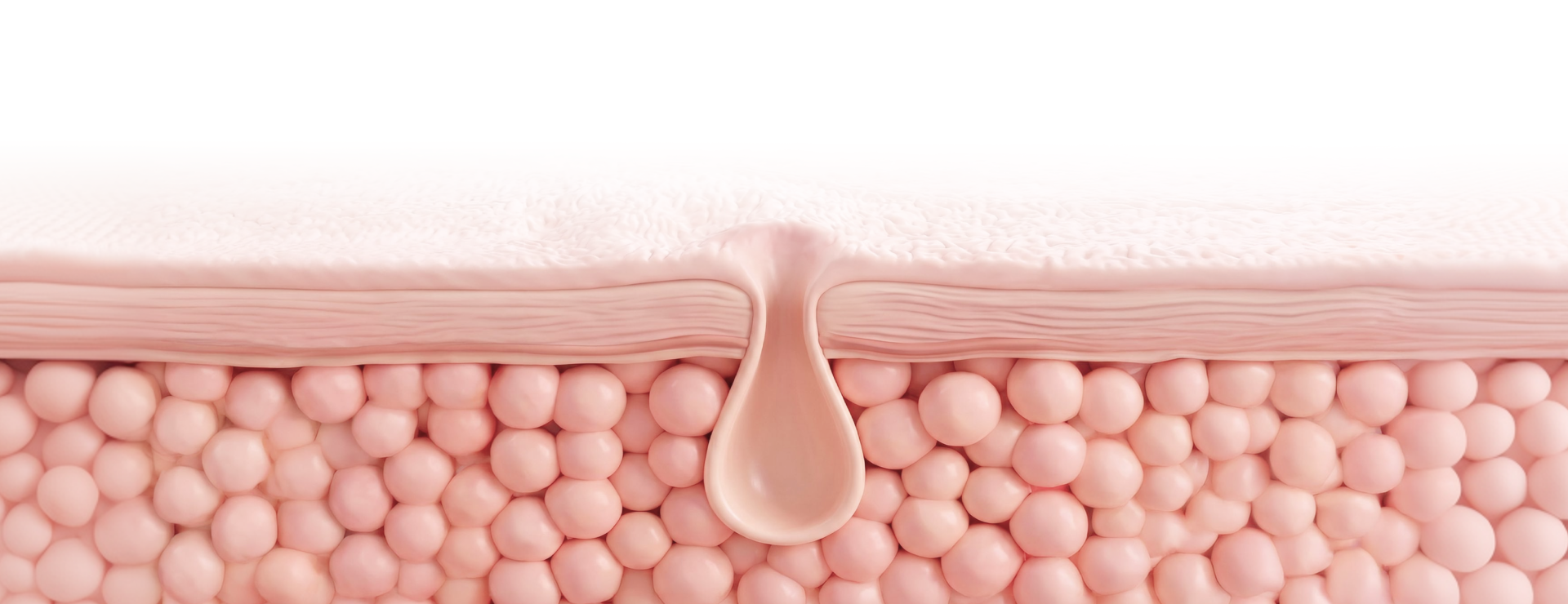 PORE CARE 디바이스와 피부 단면