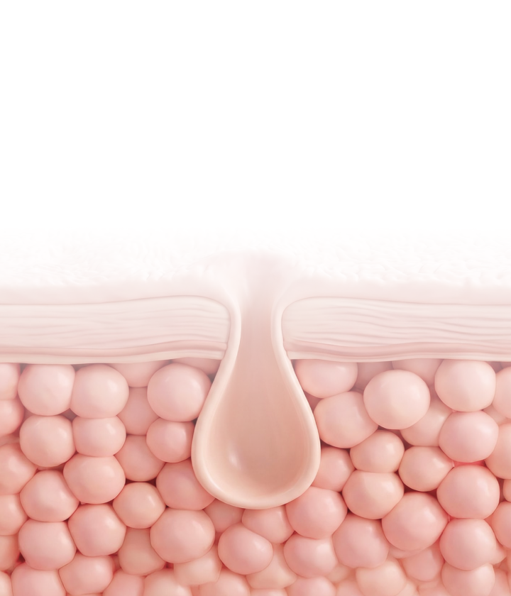 PORE CARE 디바이스와 피부 단면