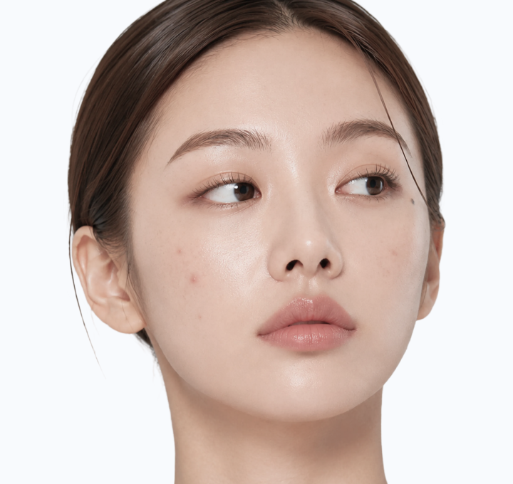 아크리부트 케어 모델